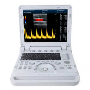 Color Doppler Ultrasonic Diagnostic System