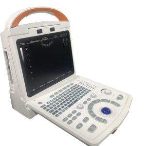 Doppler Ultrasound Diagnostic System