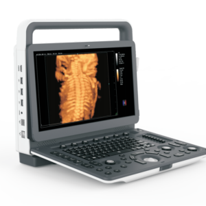 Doppler Ultrasonic System